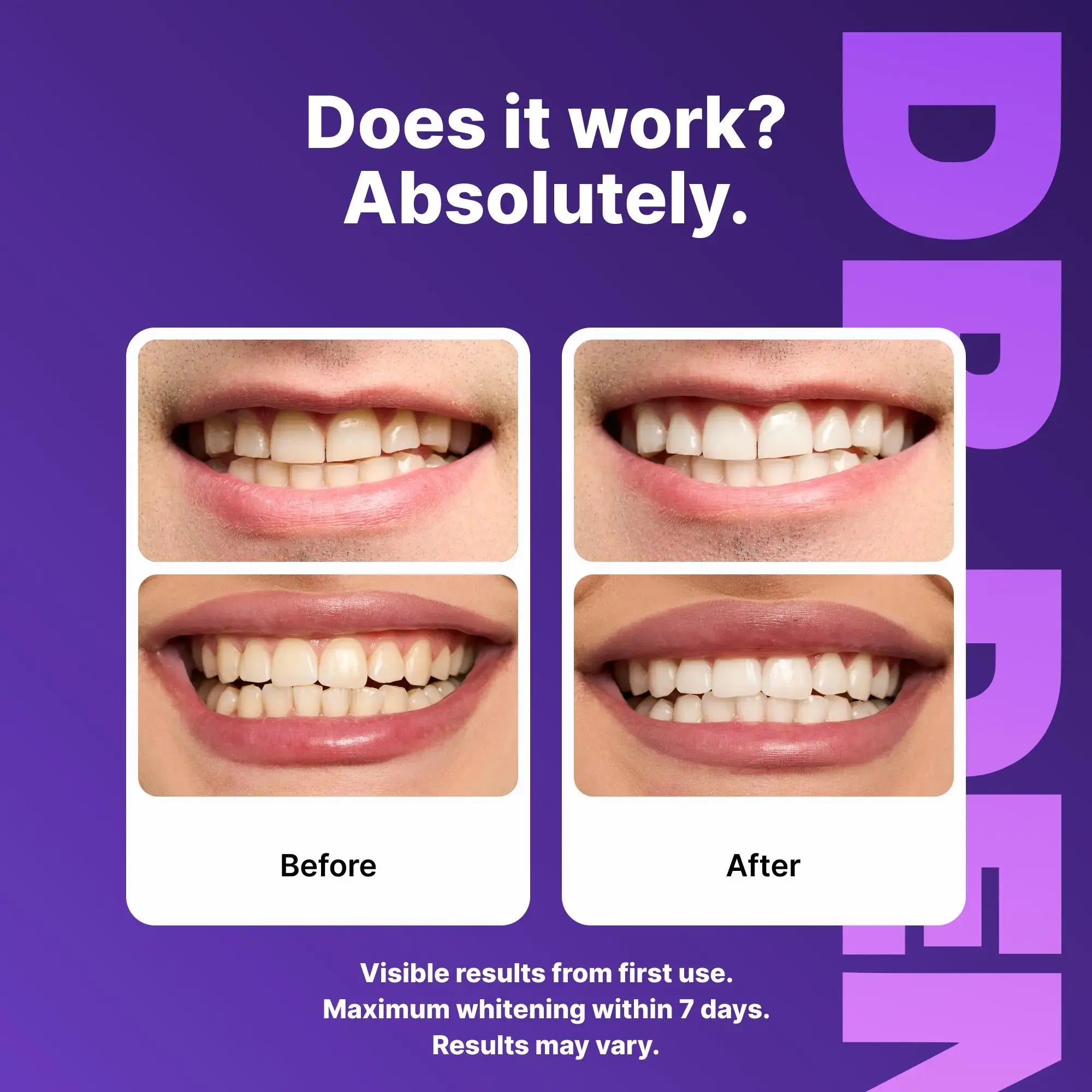 DRDENT Purple Teeth Whitening Strips - 7/21 Whitening Sessions - Safe for Enamel - Non Sensitive Teeth Whitening - Peroxide-Free Know You're Still Able