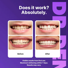 DRDENT Purple Teeth Whitening Strips - 7/21 Whitening Sessions - Safe for Enamel - Non Sensitive Teeth Whitening - Peroxide-Free Know You're Still Able
