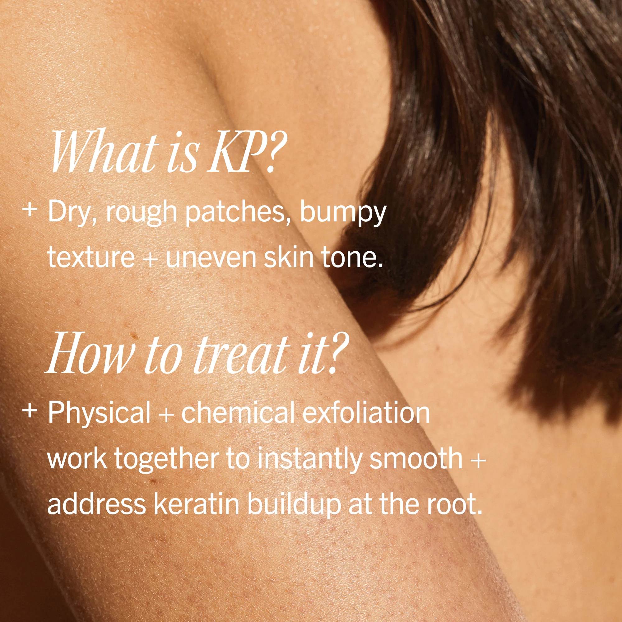 KP Bump Eraser Body Scrub 10% AHA